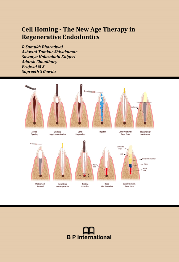 					View Cell Homing - The New Age Therapy in Regenerative Endodontics
				
