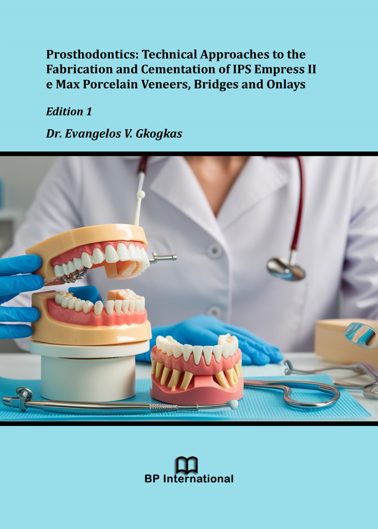 					View Prosthodontics: Technical Approaches to the Fabrication and Cementation of IPS Empress II e Max Porcelain Veneers, Bridges and Onlays, Edition 1
				